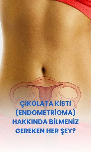 Çikolata kisti hamileliğe engel mi kadınlar kulübü