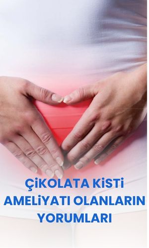 Çikolata kisti ile hamile kalmak mümkün mü