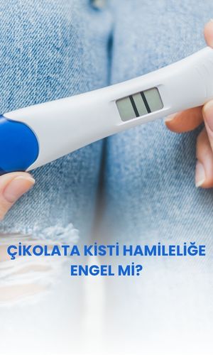 Visanne çikolata kistini yok eder mi?