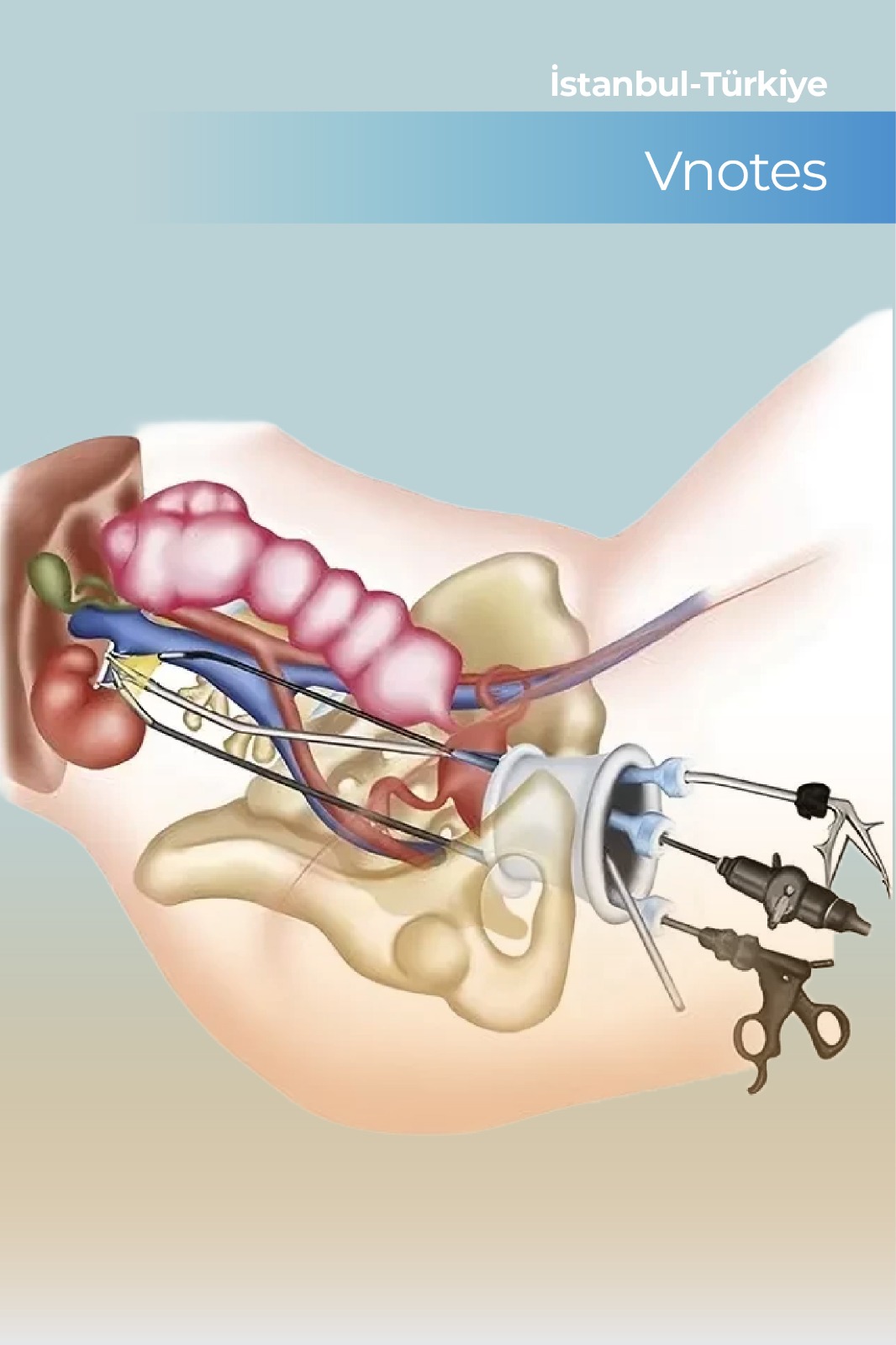 VNOTES Nedir ve İzsiz Ameliyat Yöntemi Olarak Nasıl Uygulanır