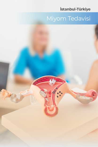 Miyom Tedavisi Nedir? Belirtileri, Nedenleri ve Modern Yöntemler
