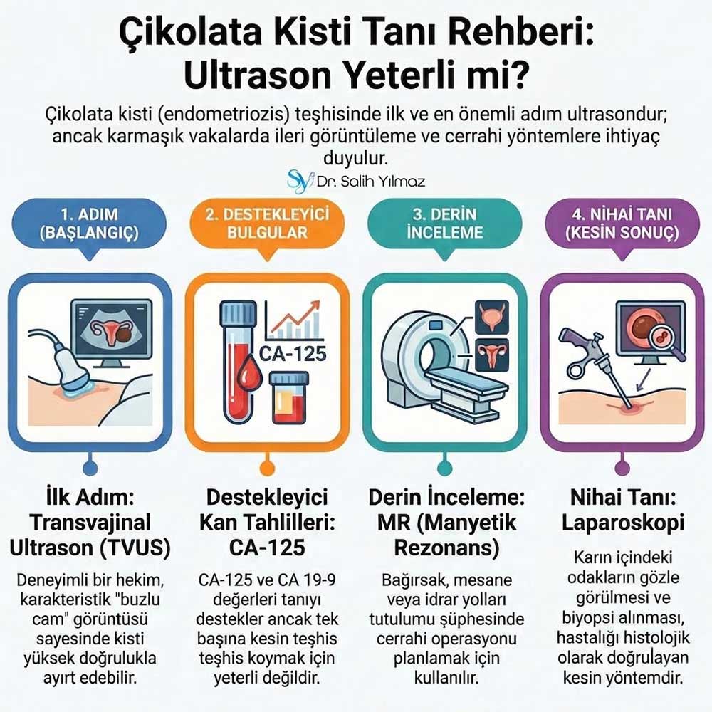 çikolata kisti ameliyatı fiyatları istanbul