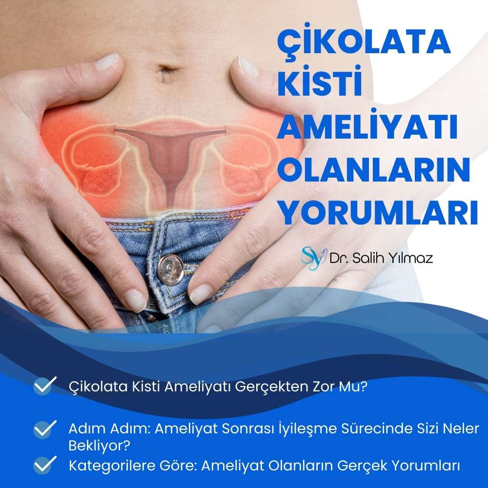 Çikolata Kisti Ameliyatı Olanların Yorumları