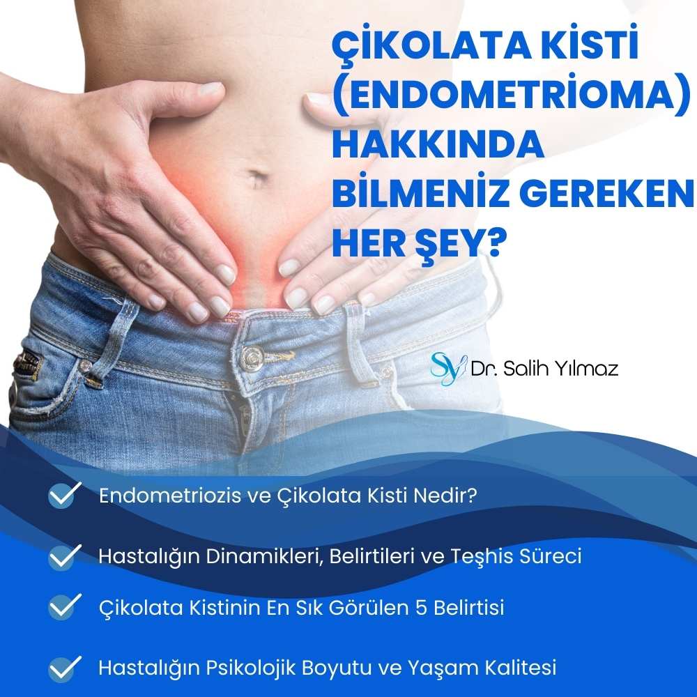 Çikolata Kisti (Endometrioma) Hakkında Bilmeniz Gereken Her Şey