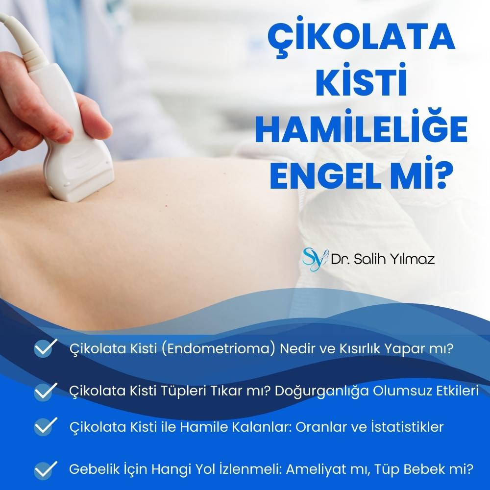 Çikolata Kisti Hamileliğe Engel mi