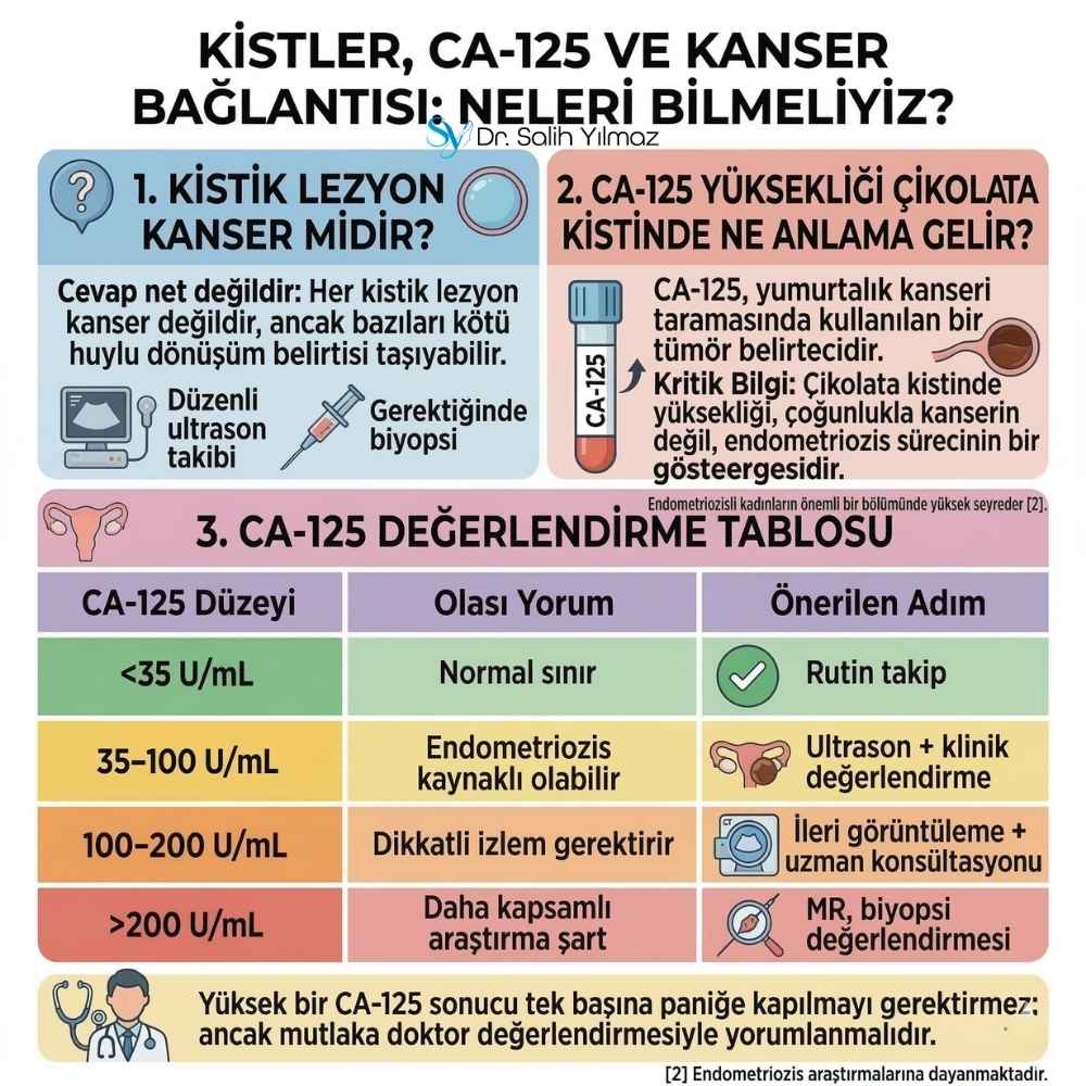 Çikolata kisti kanser olur mu