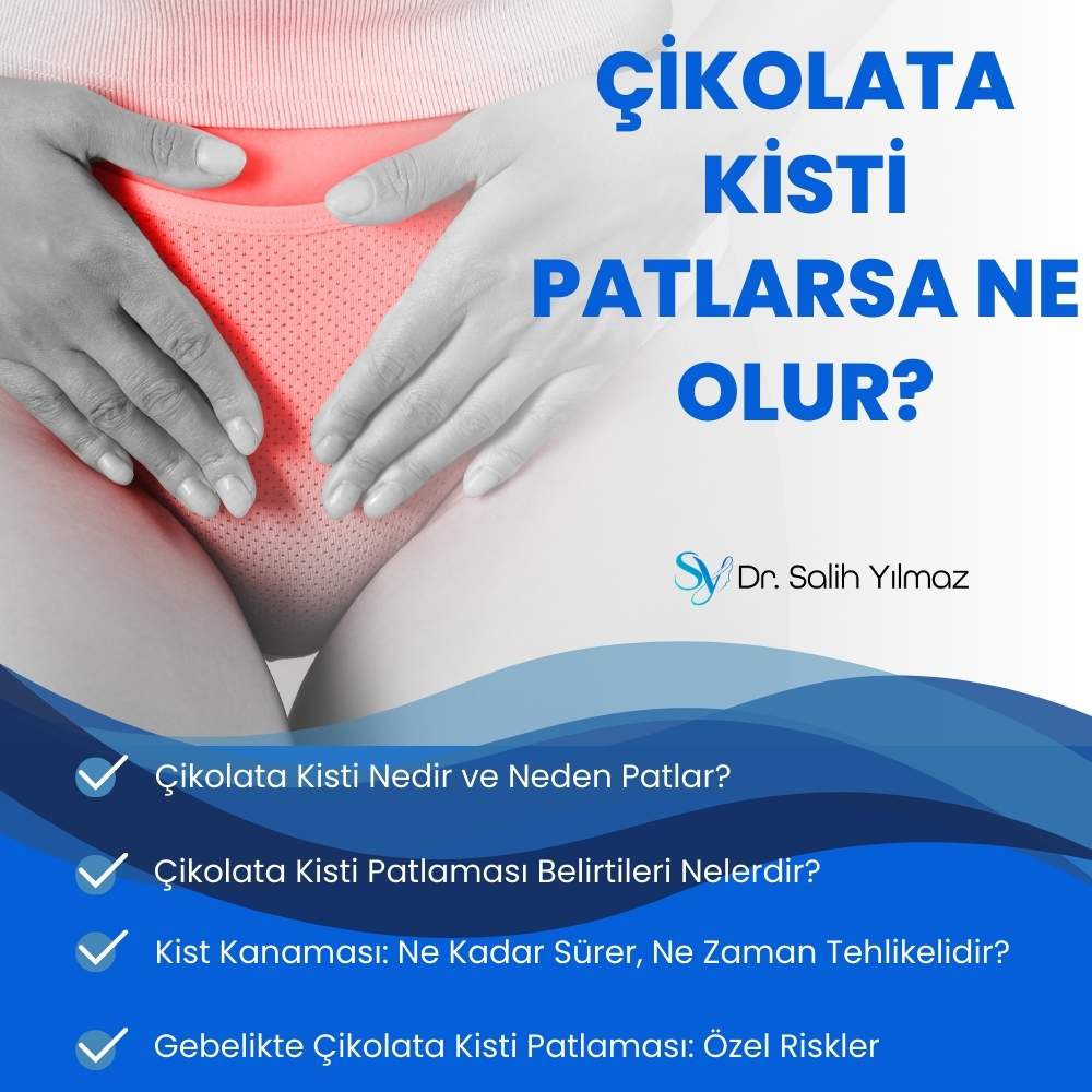Çikolata Kisti Patlarsa Ne Olur