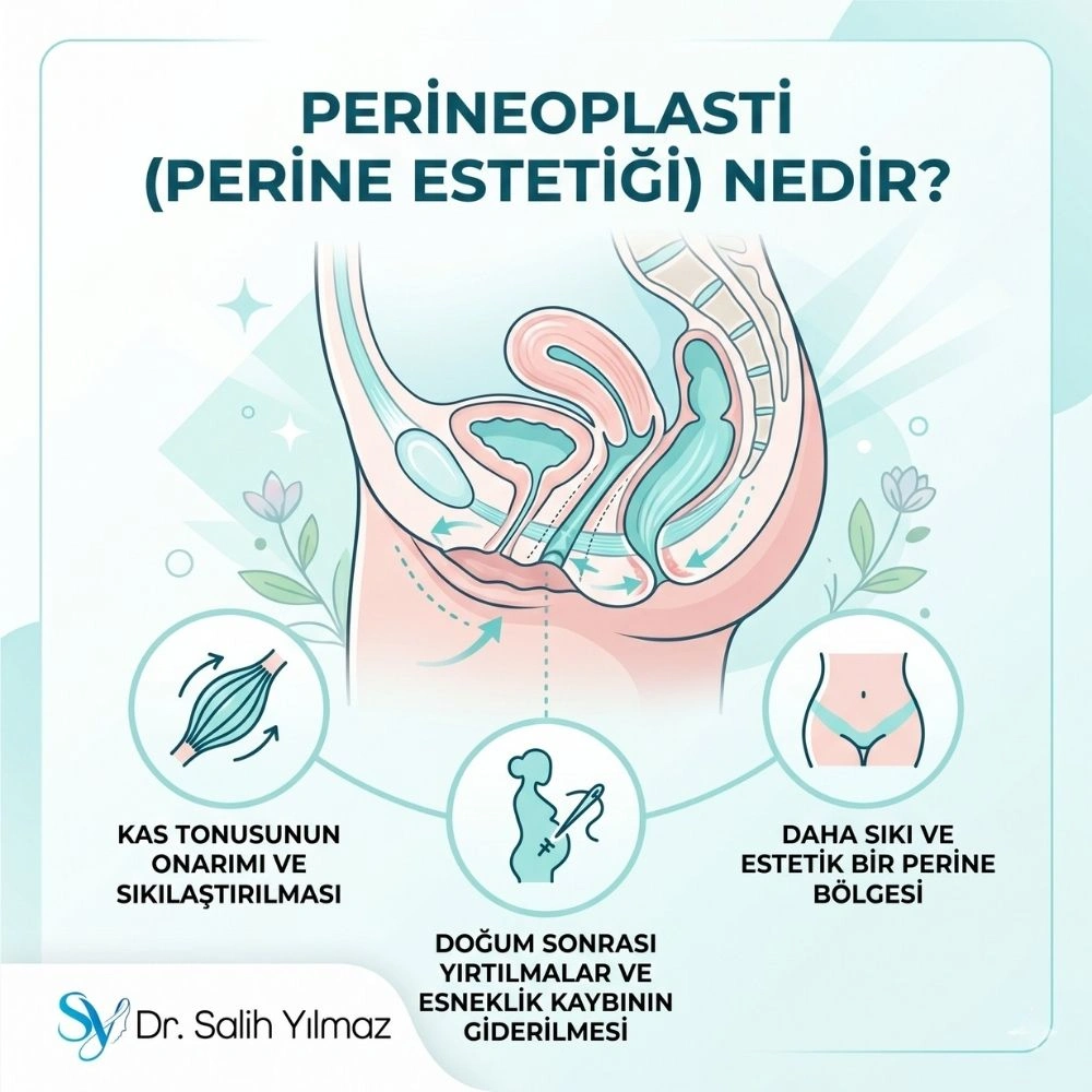 perineoplasti nedir istanbul