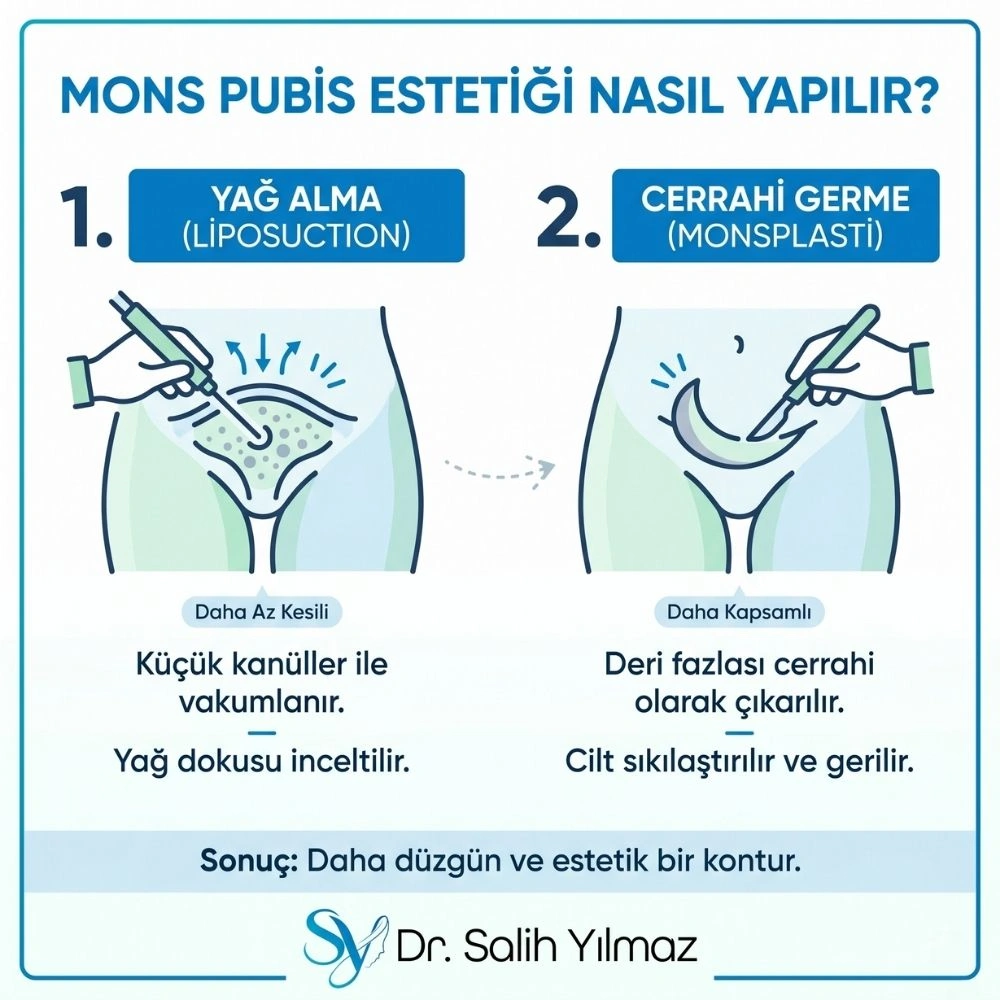 bikini-bolgesi-estetigi istanbul