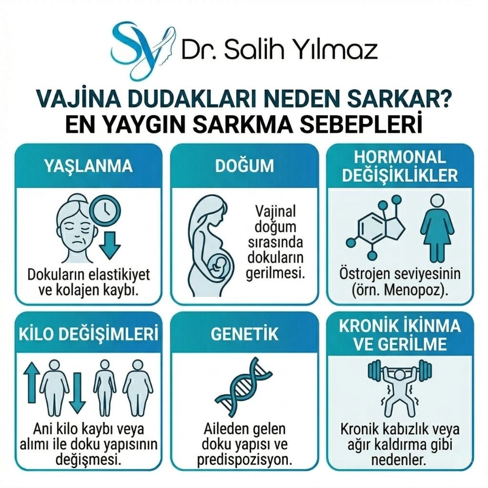 vajina dış dudak sarkması