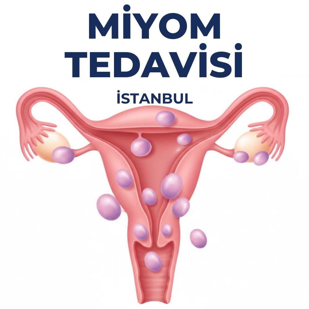 İstanbul miyom tedavisi 