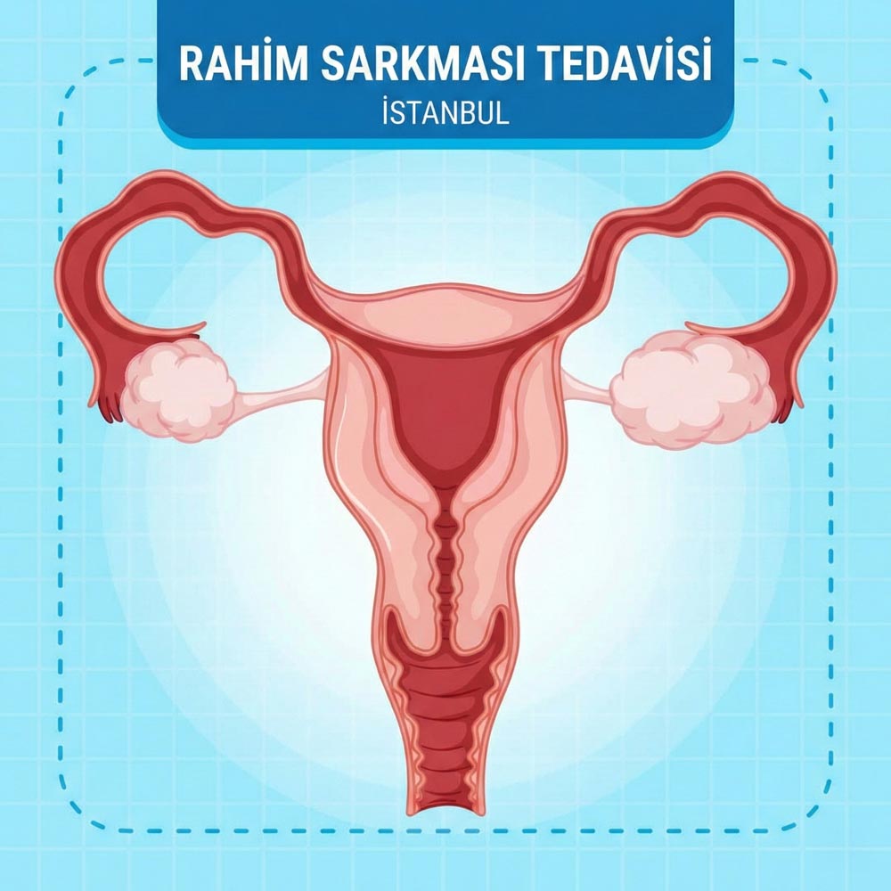 Rahim Sarkması Tedavisi istanbul