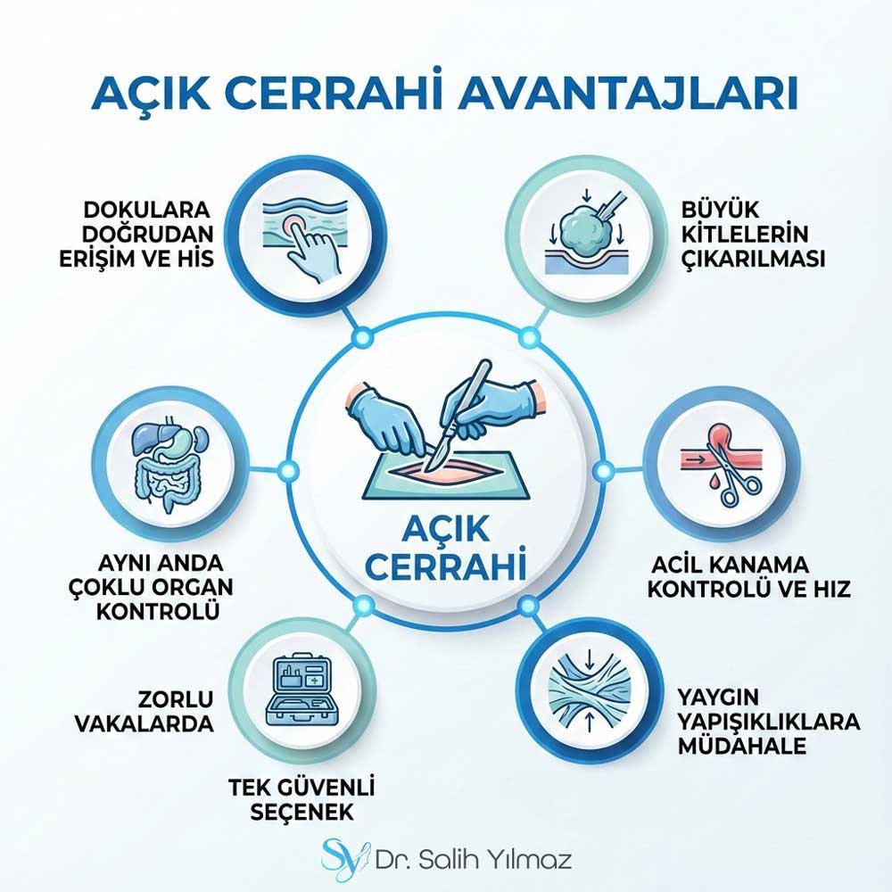 Açık Cerrahinin Avantajları istanbul