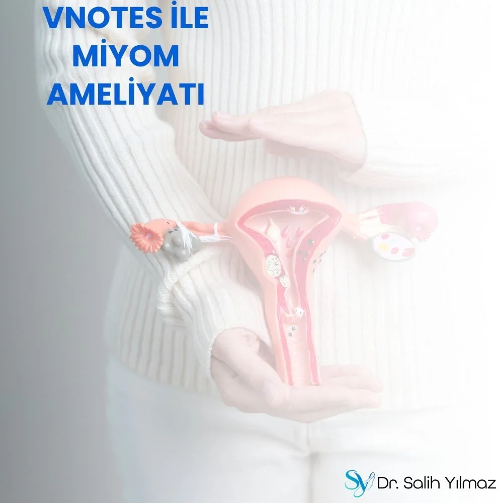 Vnotes ile Miyom ameliyatı